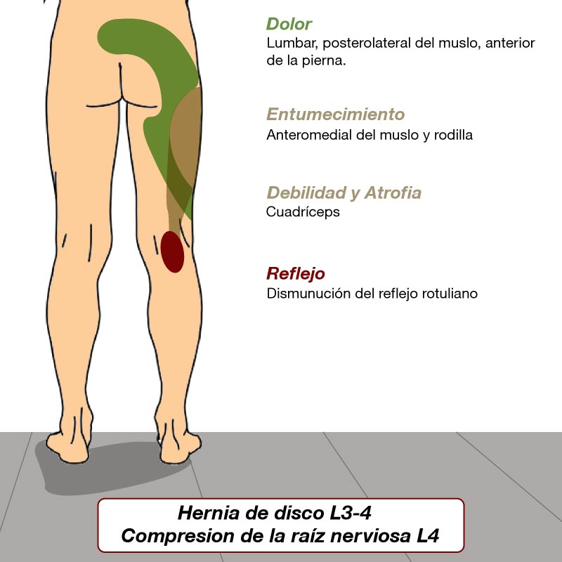 adicional2